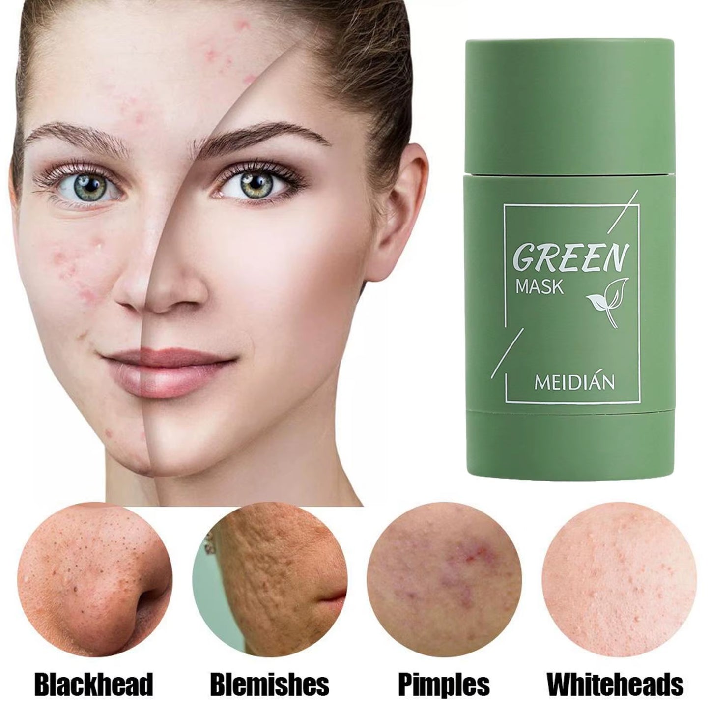 Revitalize Your Skin with Our Natural Green Tea Cleansing Mask - Acne Treatment & Blackhead Remover!